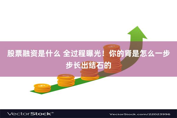 股票融资是什么 全过程曝光！你的肾是怎么一步步长出结石的